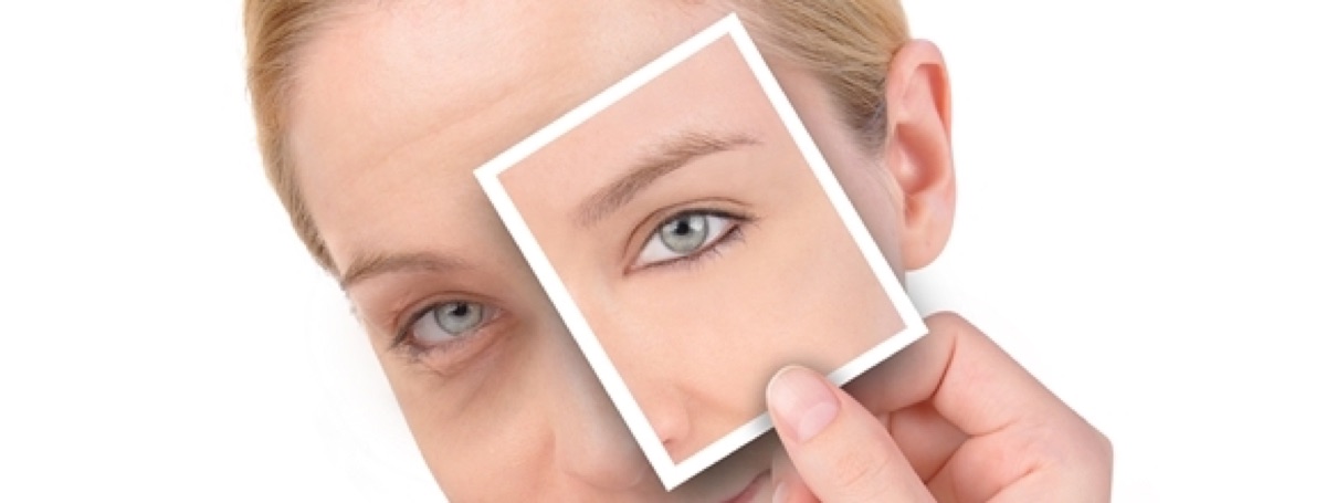 Dark Eye Circles at Beauty Bar by Akhlas